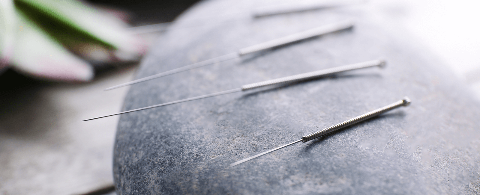 Acupuncture-1600x651 | OnPoint Internal Medicine at Harvard Park